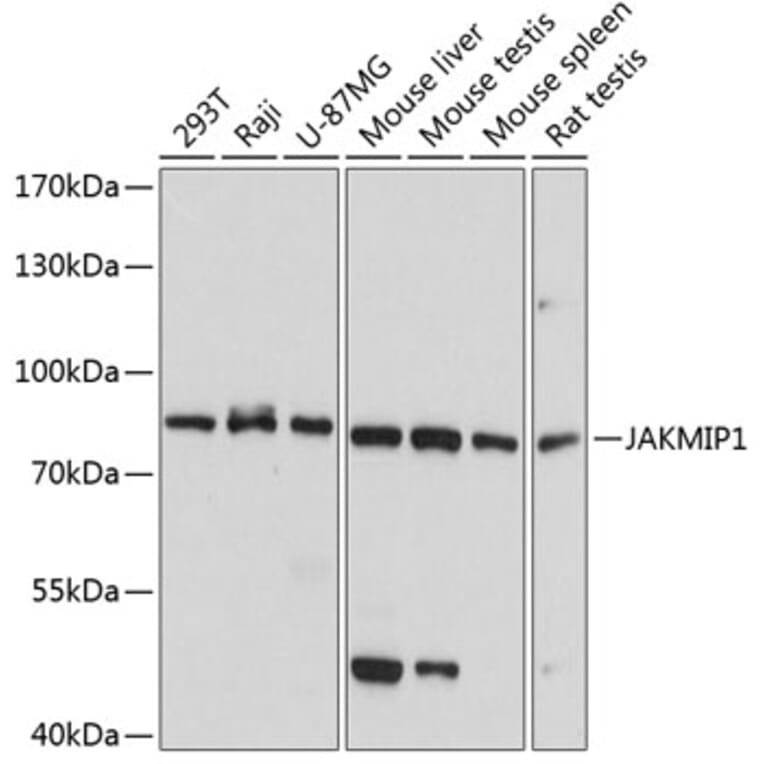 Western Blot - Anti-JAKMIP1 Antibody (A5178) - Antibodies.com