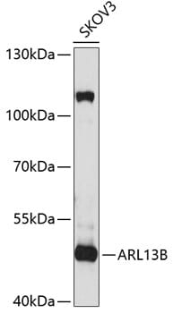 Western blot analysis of extracts of SKOV3 cells, using Anti-ARL13B Antibody (A5200) at 1:1,000 dilution.
Secondary antibody: Goat Anti-Rabbit IgG (H+L) (HRP) (AS014) at 1:10,000 dilution.
Lysates / proteins: 25µg per lane.
Blocking buffer: 3% non-fat dry milk in TBST.
Detection: ECL Basic Kit (RM00020).
Exposure time: 30s.