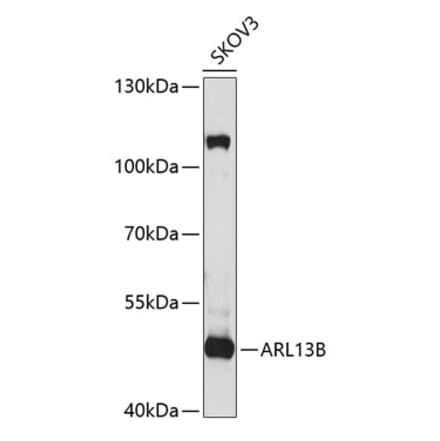 Western Blot - Anti-ARL13B Antibody (A9675) - Antibodies.com