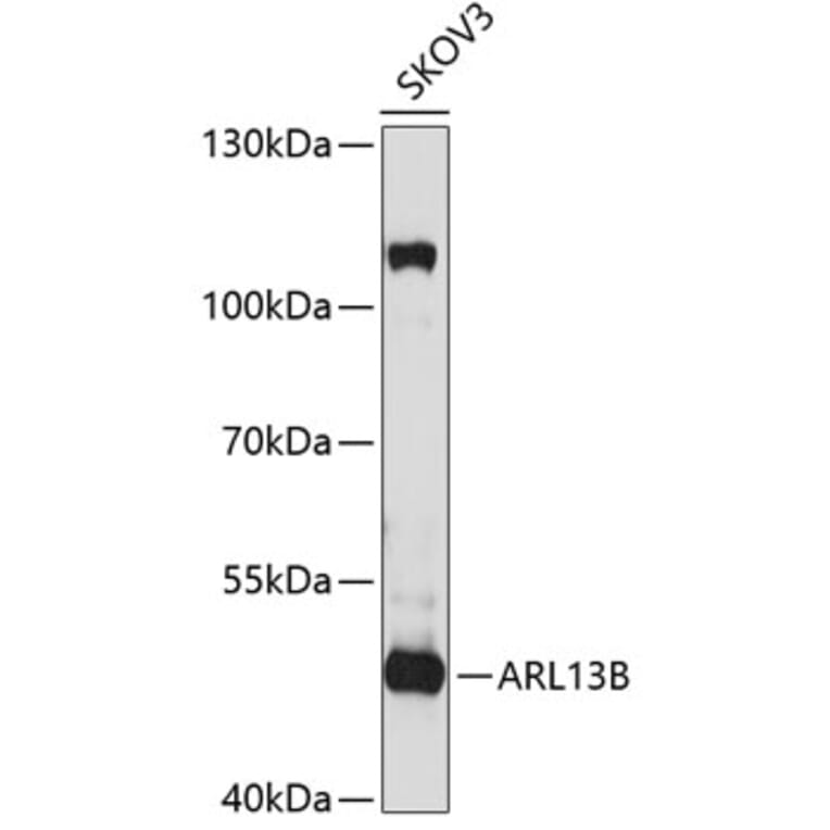 Western Blot - Anti-ARL13B Antibody (A9675) - Antibodies.com