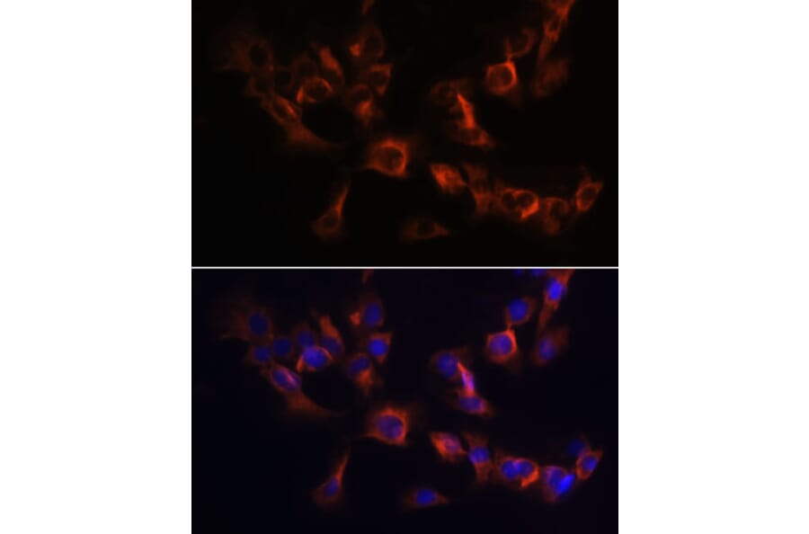 Immunofluorescence - Anti-ARL13B Antibody (A9675) - Antibodies.com