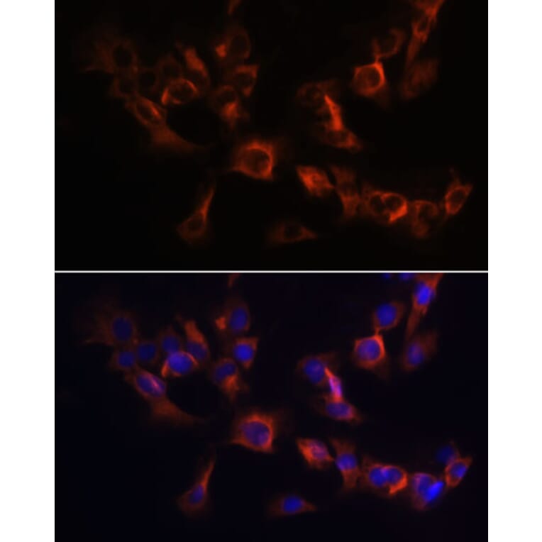 Immunofluorescence - Anti-ARL13B Antibody (A9675) - Antibodies.com