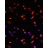Immunofluorescence - Anti-ARL13B Antibody (A9675) - Antibodies.com