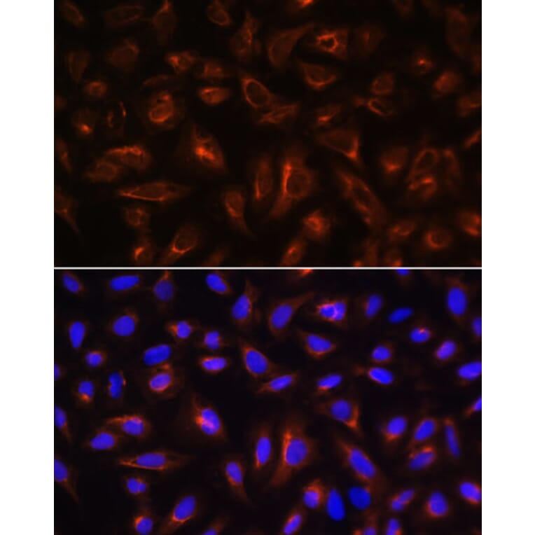 Immunofluorescence - Anti-ARL13B Antibody (A9675) - Antibodies.com