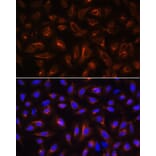 Immunofluorescence - Anti-ARL13B Antibody (A9675) - Antibodies.com