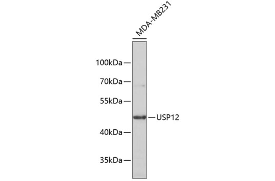Western Blot - Anti-USP12 Antibody (A5201) - Antibodies.com