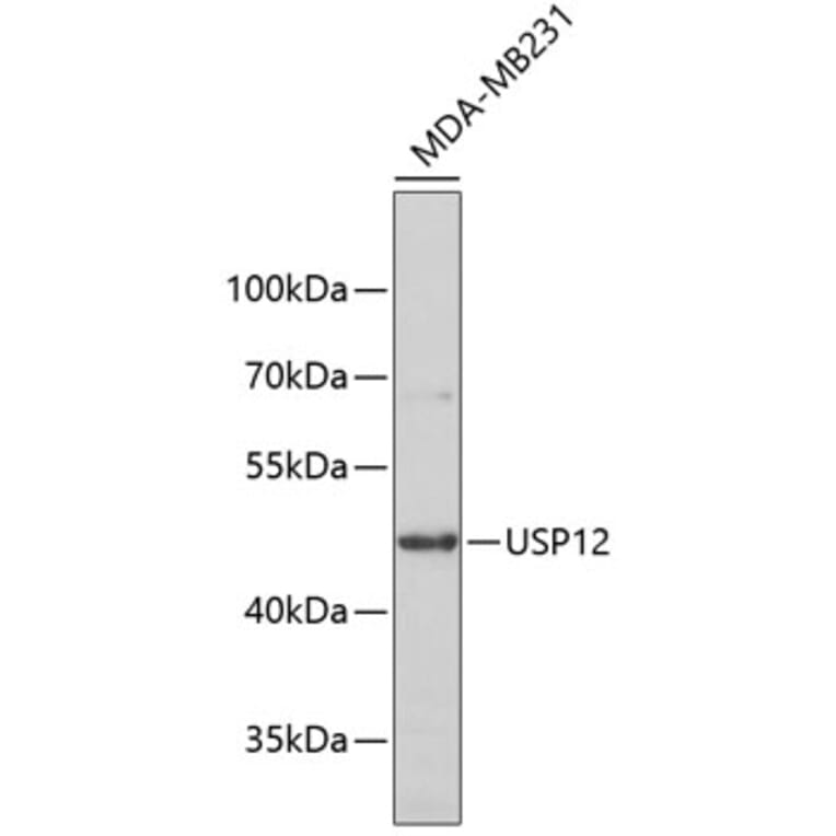 Western Blot - Anti-USP12 Antibody (A5201) - Antibodies.com