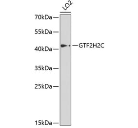 Western Blot - Anti-GTF2H2C Antibody (A9684) - Antibodies.com