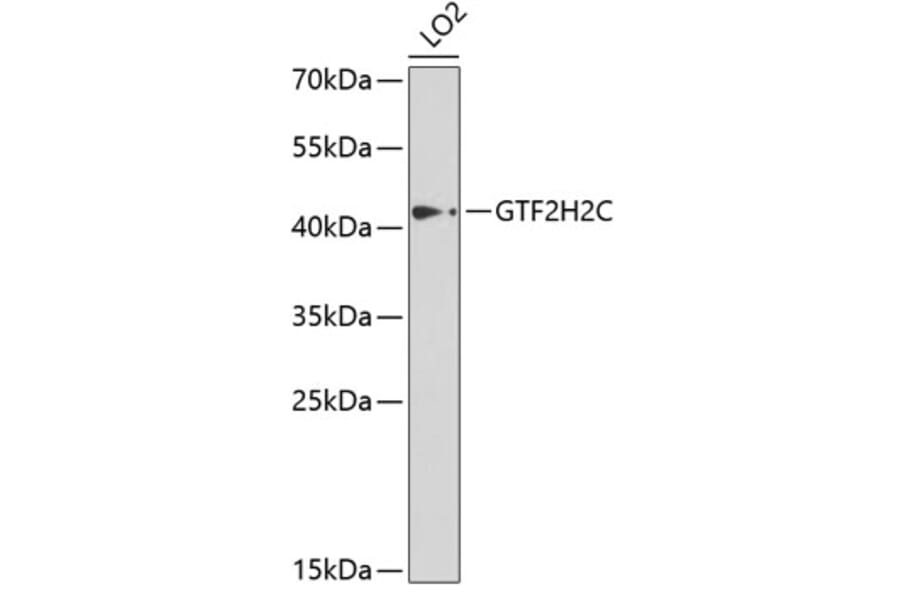 Western Blot - Anti-GTF2H2C Antibody (A9684) - Antibodies.com