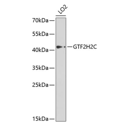 Western Blot - Anti-GTF2H2C Antibody (A9684) - Antibodies.com