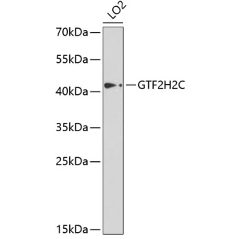 Western Blot - Anti-GTF2H2C Antibody (A9684) - Antibodies.com