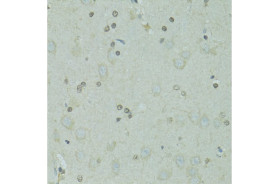 Immunohistochemistry - Anti-GTF2H2C Antibody (A9684) - Antibodies.com