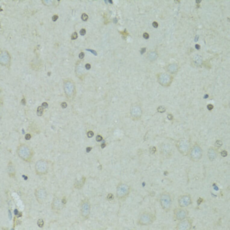 Immunohistochemistry - Anti-GTF2H2C Antibody (A9684) - Antibodies.com