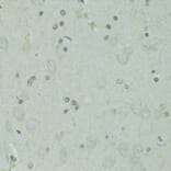 Immunohistochemistry - Anti-GTF2H2C Antibody (A9684) - Antibodies.com