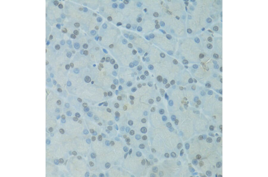 Immunohistochemistry - Anti-GTF2H2C Antibody (A9684) - Antibodies.com