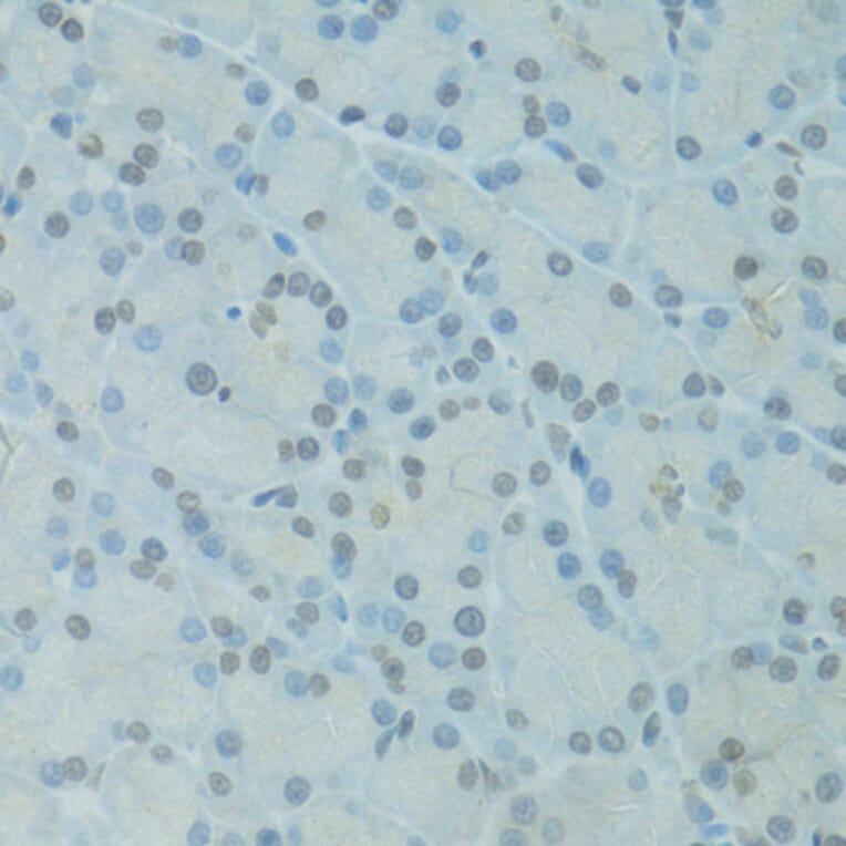 Immunohistochemistry - Anti-GTF2H2C Antibody (A9684) - Antibodies.com