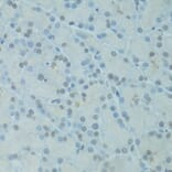 Immunohistochemistry - Anti-GTF2H2C Antibody (A9684) - Antibodies.com