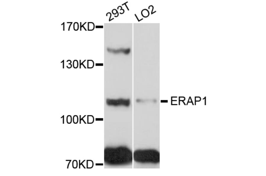 Western Blot - Anti-ERAP1 Antibody (A5248) - Antibodies.com