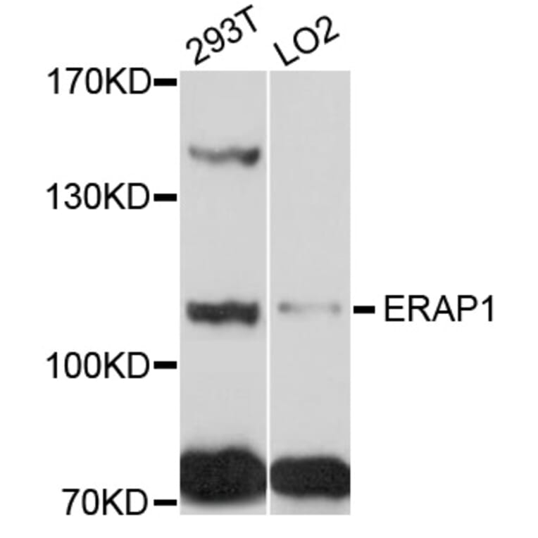 Western Blot - Anti-ERAP1 Antibody (A5248) - Antibodies.com