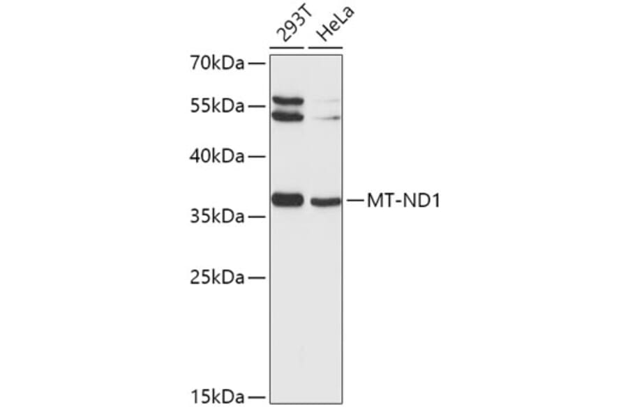 Western Blot - Anti-MT-ND1 Antibody (A9688) - Antibodies.com