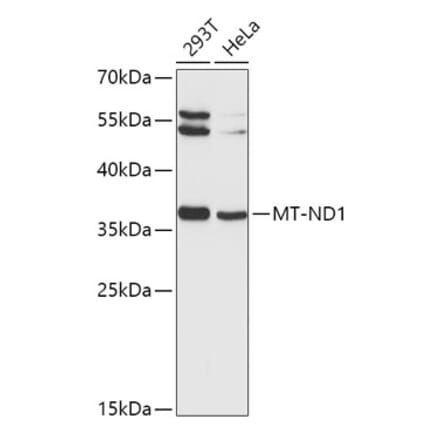 Western Blot - Anti-MT-ND1 Antibody (A9688) - Antibodies.com
