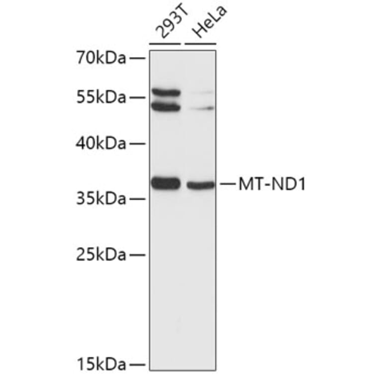 Western Blot - Anti-MT-ND1 Antibody (A9688) - Antibodies.com