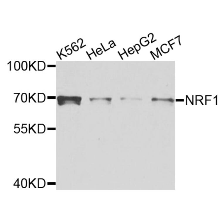Western Blot - Anti-NRF1 Antibody (A5264) - Antibodies.com