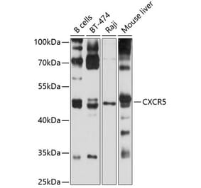 Western Blot - Anti-CXCR5 Antibody (A9692) - Antibodies.com