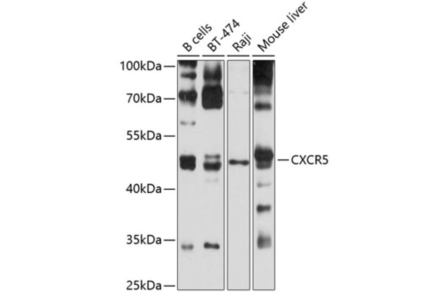 Western Blot - Anti-CXCR5 Antibody (A9692) - Antibodies.com