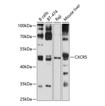 Western Blot - Anti-CXCR5 Antibody (A9692) - Antibodies.com