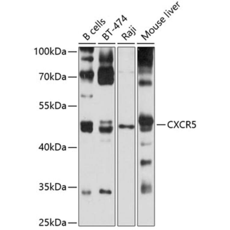 Western Blot - Anti-CXCR5 Antibody (A9692) - Antibodies.com
