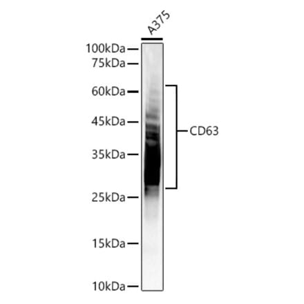 Western Blot - Anti-CD63 Antibody (A9694) - Antibodies.com