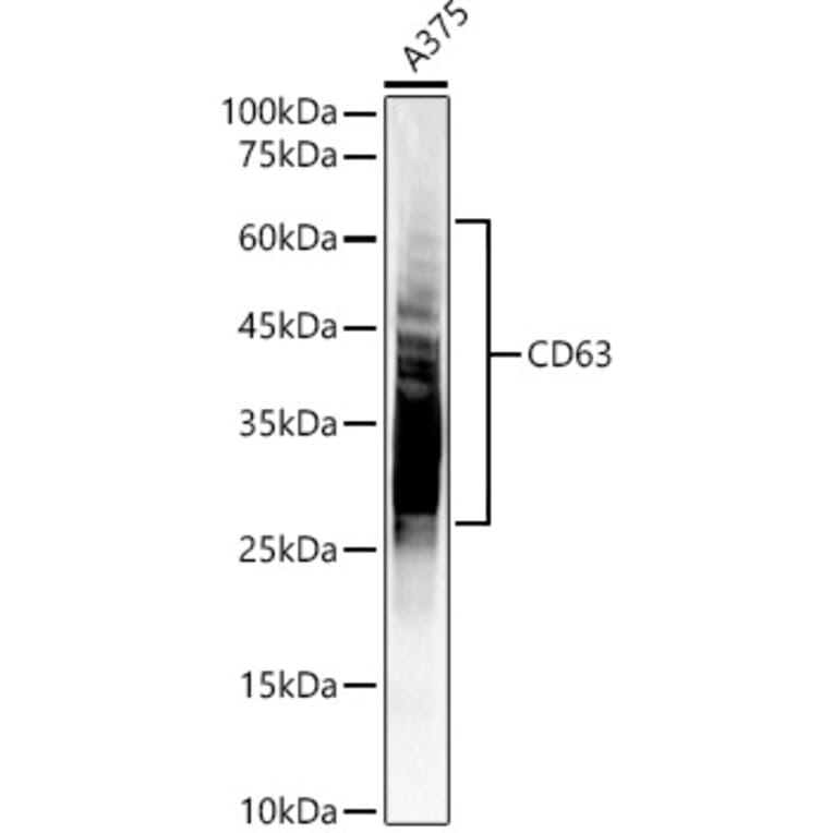 Western Blot - Anti-CD63 Antibody (A9694) - Antibodies.com