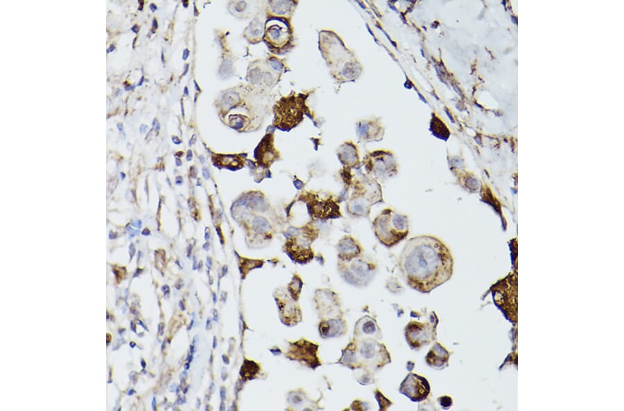 Immunohistochemistry - Anti-CD63 Antibody (A9694) - Antibodies.com