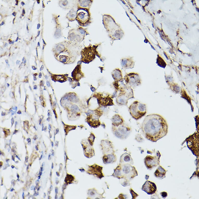 Immunohistochemistry - Anti-CD63 Antibody (A9694) - Antibodies.com