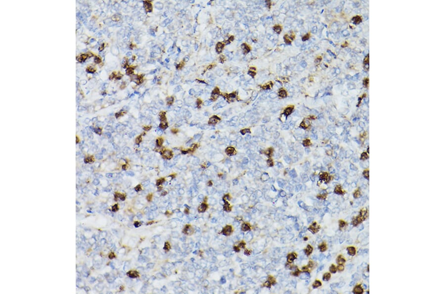Immunohistochemistry - Anti-CD63 Antibody (A9694) - Antibodies.com