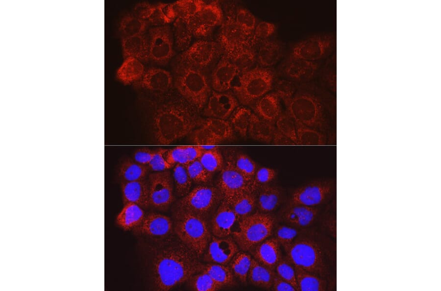 Immunofluorescence - Anti-CD63 Antibody (A9694) - Antibodies.com