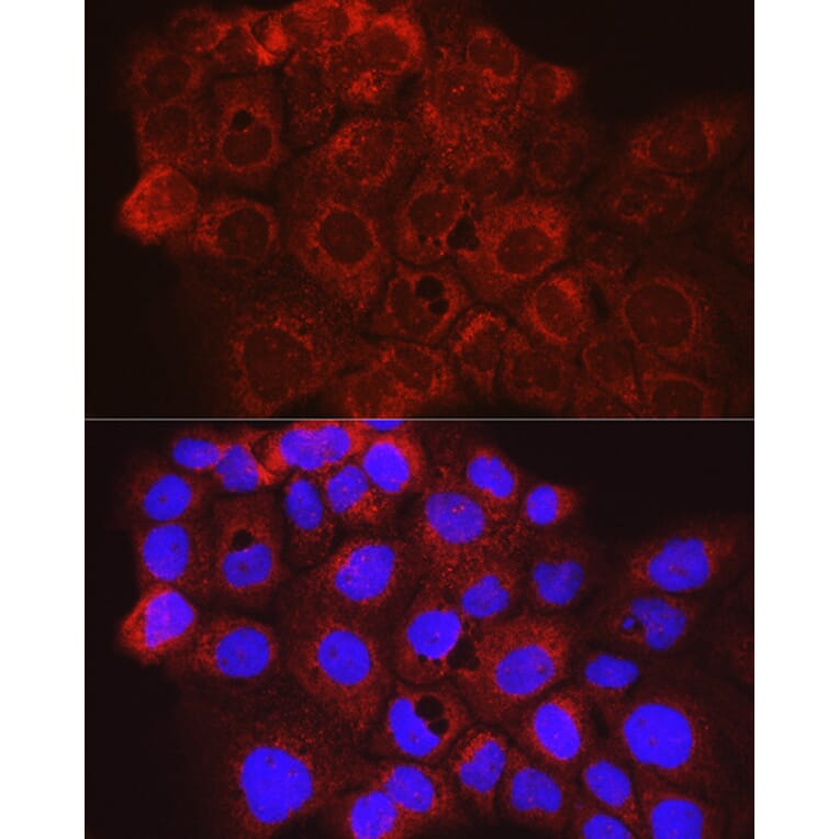 Immunofluorescence - Anti-CD63 Antibody (A9694) - Antibodies.com