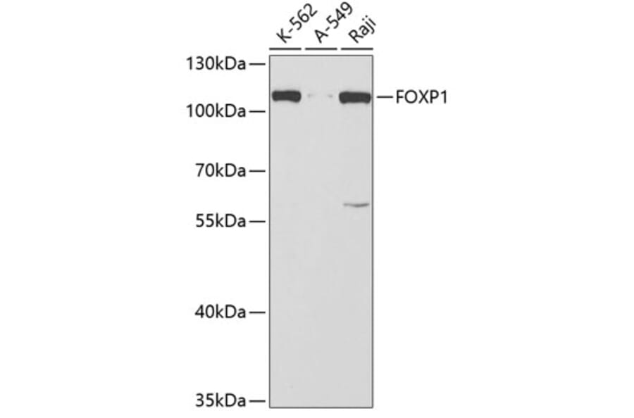 Western Blot - Anti-FOXP1 Antibody (A5272) - Antibodies.com