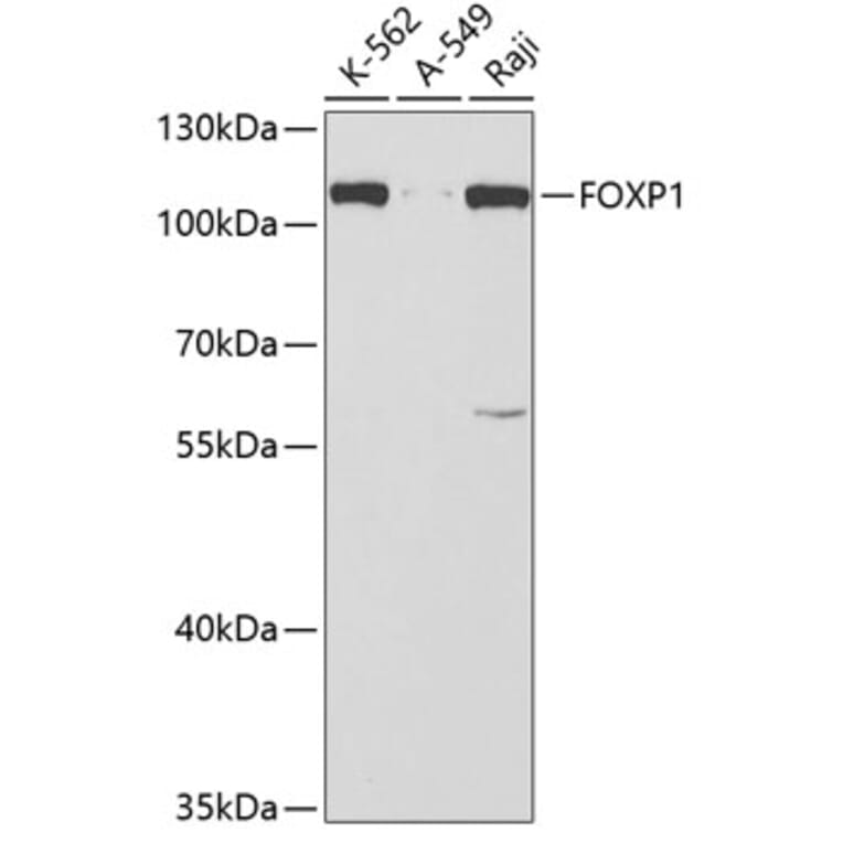 Western Blot - Anti-FOXP1 Antibody (A5272) - Antibodies.com