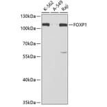Western Blot - Anti-FOXP1 Antibody (A5272) - Antibodies.com