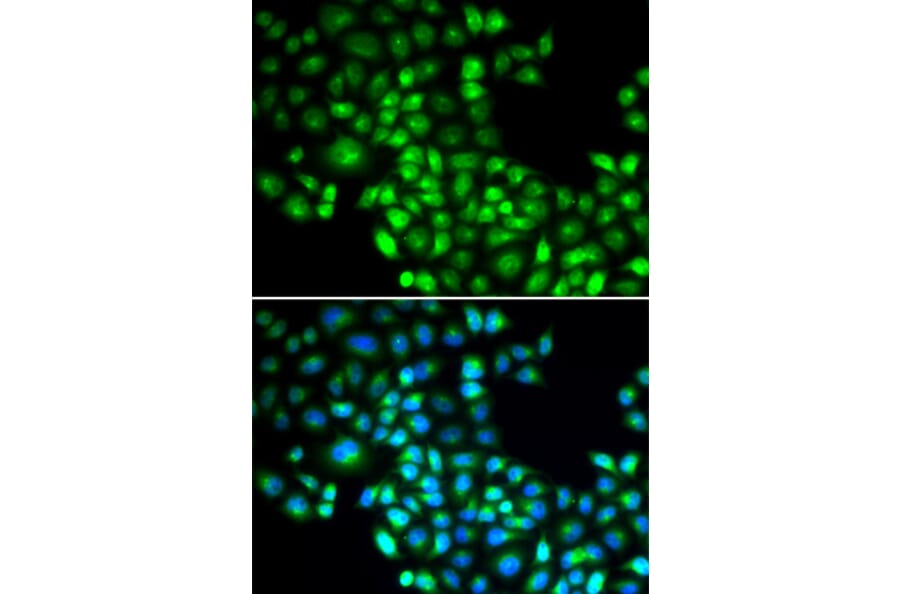 Immunofluorescence - Anti-FOXP1 Antibody (A5272) - Antibodies.com