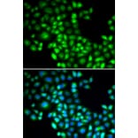 Immunofluorescence - Anti-FOXP1 Antibody (A5272) - Antibodies.com