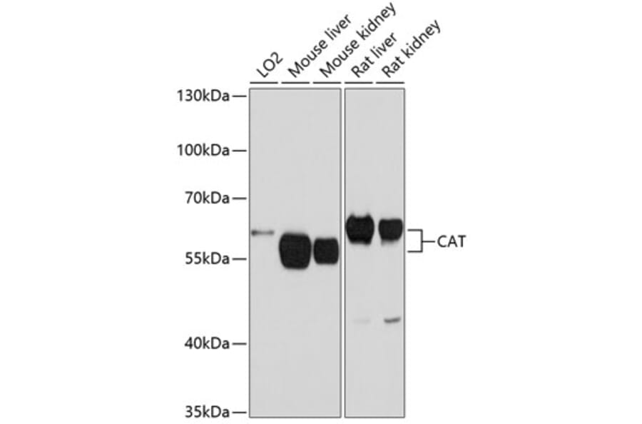 Western Blot - Anti-CAT Antibody (A5275) - Antibodies.com