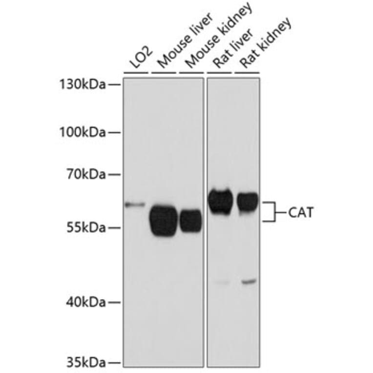 Western Blot - Anti-CAT Antibody (A5275) - Antibodies.com