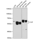 Western Blot - Anti-CAT Antibody (A5275) - Antibodies.com