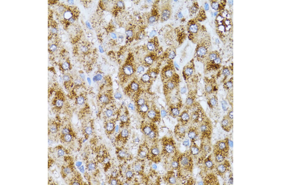 Immunohistochemistry - Anti-CAT Antibody (A5275) - Antibodies.com