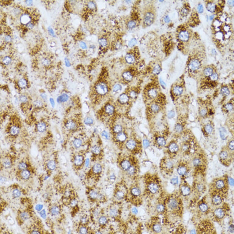 Immunohistochemistry - Anti-CAT Antibody (A5275) - Antibodies.com