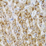 Immunohistochemistry - Anti-CAT Antibody (A5275) - Antibodies.com