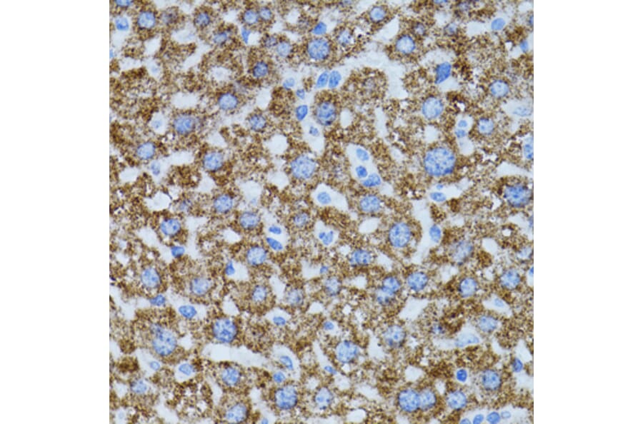 Immunohistochemistry - Anti-CAT Antibody (A5275) - Antibodies.com